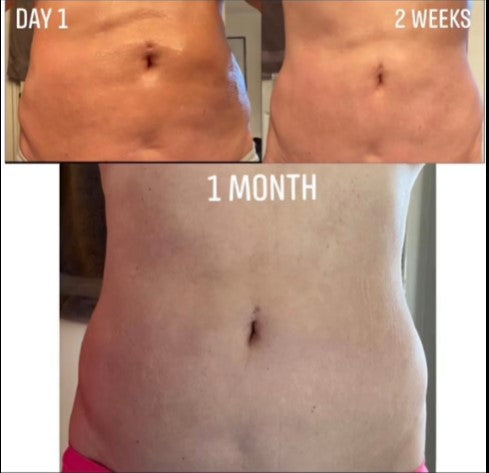 BESTGOD Massage Roller - BestGod®